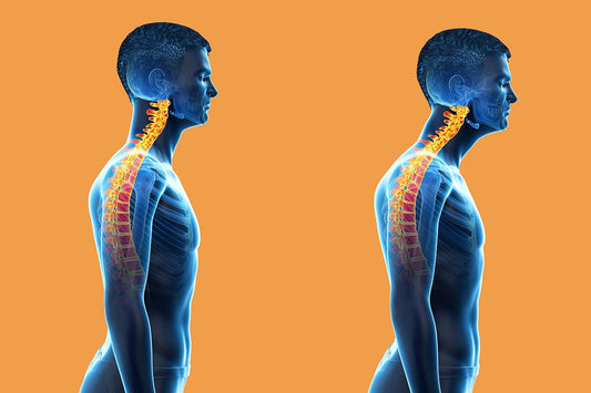 Text Neck-Forward Head Posture