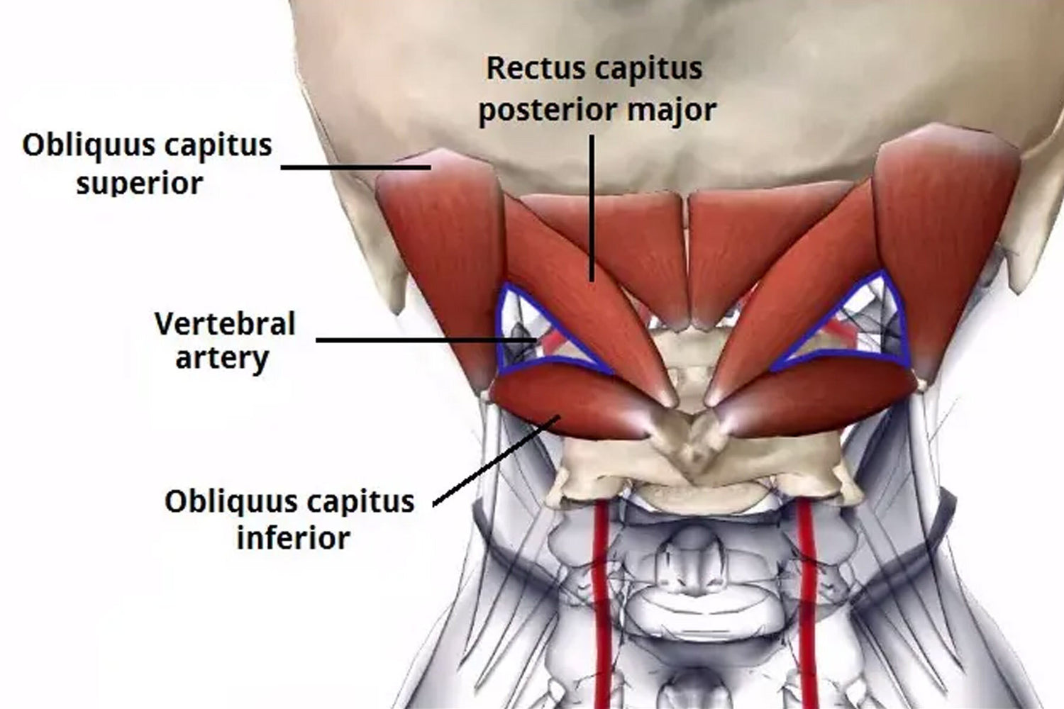 The Ultimate Guide to the Suboccipital Muscles – Iron Neck UK & Europe